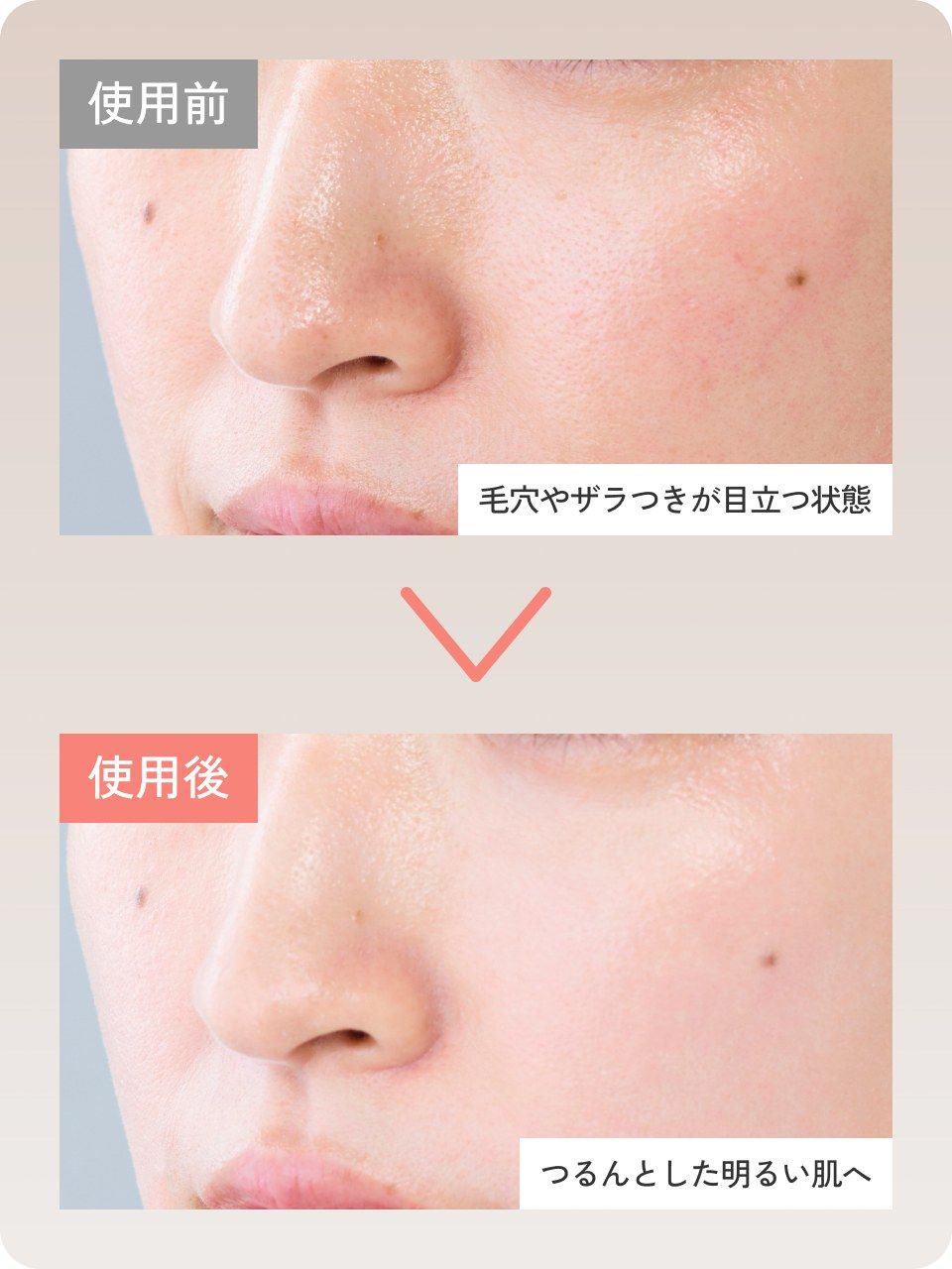 使用前：毛穴やザラつきが目立つ状態／使用後：つるんとした明るい肌へ