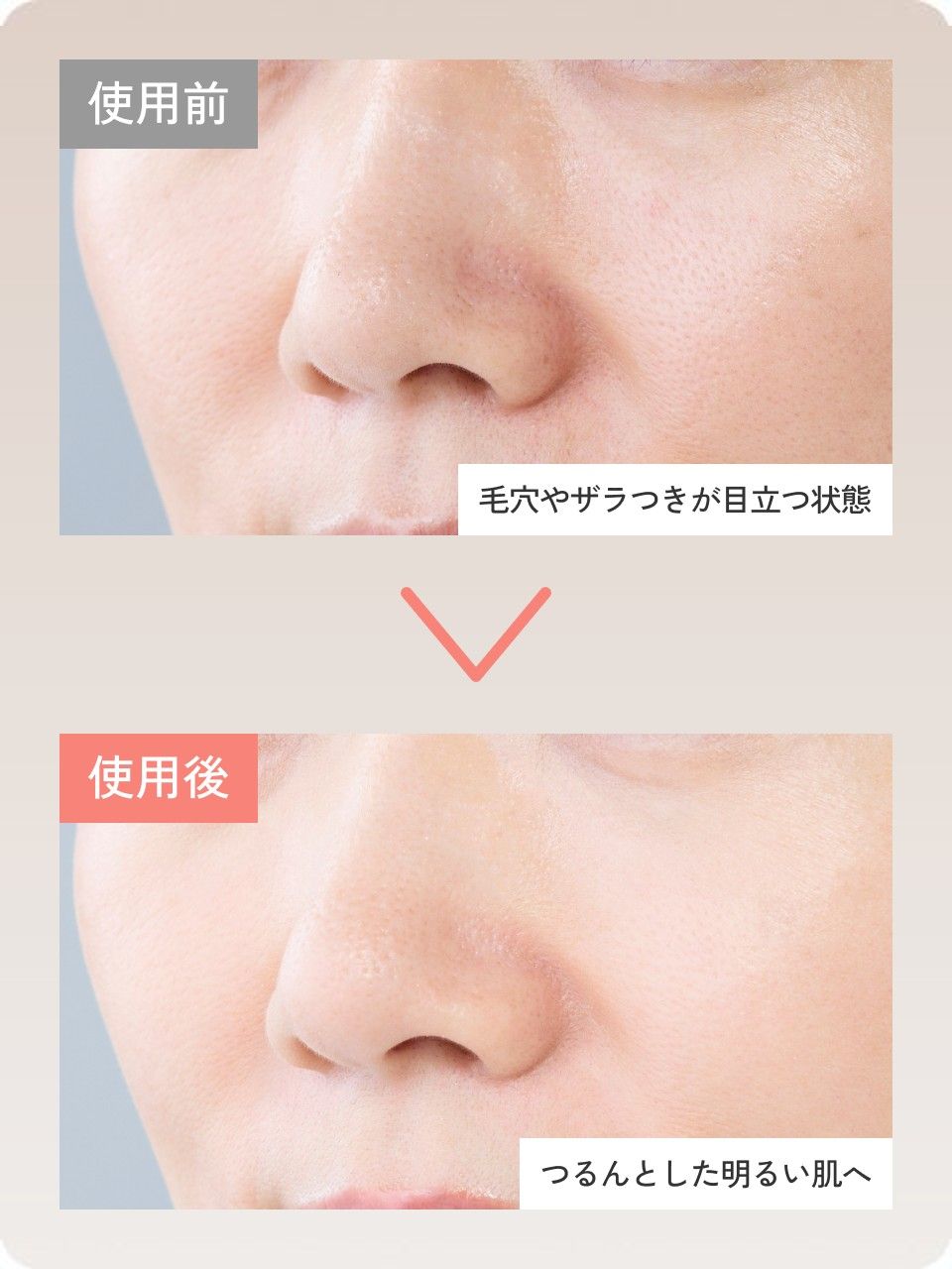 使用前：毛穴やザラつきが目立つ状態／使用後：つるんとした明るい肌へ
